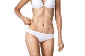 Get the Figure You’ve Always Wanted: Tummy Tuck Miami
