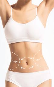 Miami’s Marvelous Makeover: A Symphony of Tummy Tuck Magic